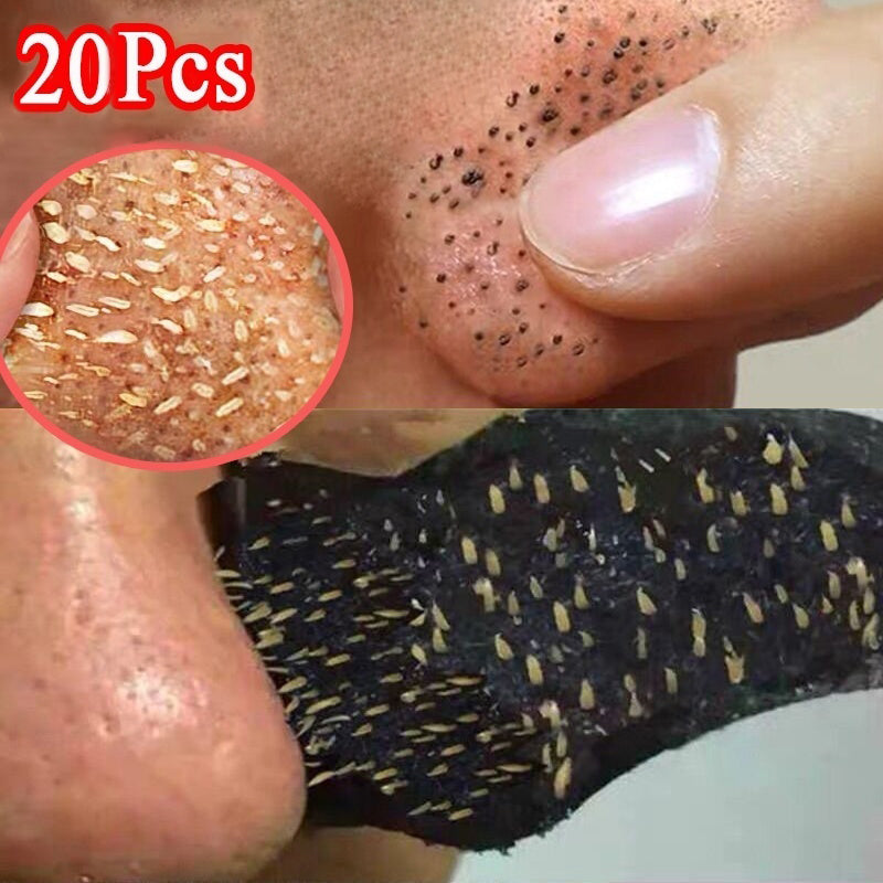 20pc Bamboo Charcoal Blackhead  Mask Blackhead Spots Acne Treatment Mask Nose Sticker Cleaner Nose Pore Deep Clean Strip